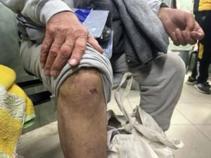 img_20240203_232109_9665411457399474174877-300x225 A number of Palestinians received medical treatment at Anjjar hospital after they were released by the Israeli occupation forces in Rafah city.