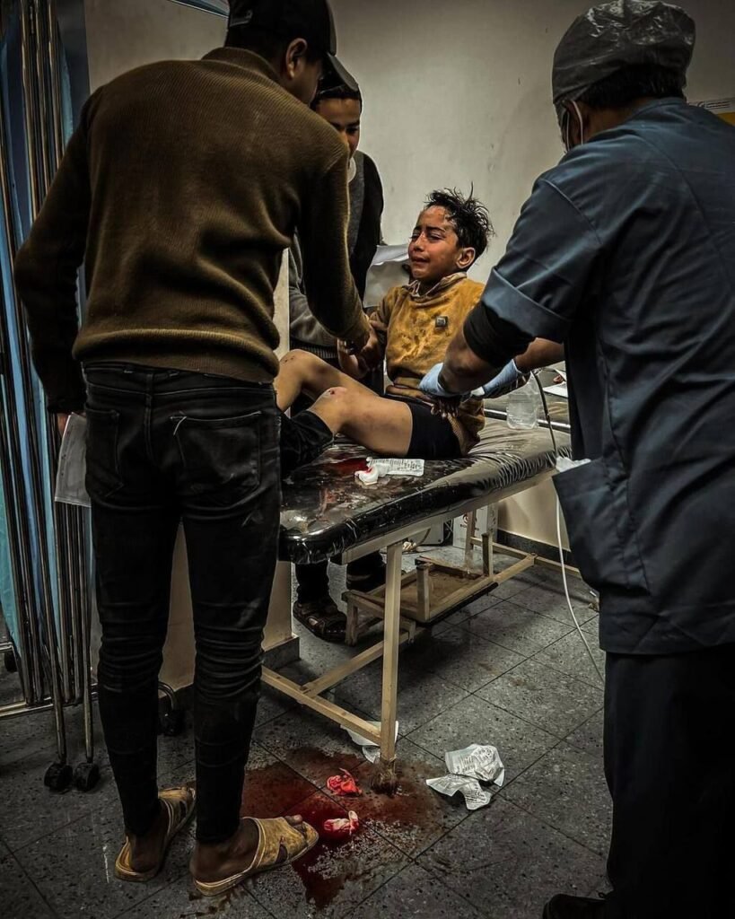 img_20240302_212744_7185686212752551142218-819x1024 Palestinian children were injured by an Israeli air strike that targeted the abu ghali family home, in Rafah in the southern Gaza Strip.
