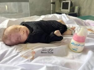 img_20240302_213032_0245228595650762850943-300x225 She got some milk but it was too late .. the baby girl Heba Ziadeh died in Kamal Al-Adwan Hospital in northern Gaza due to dehydration and malnutrition.