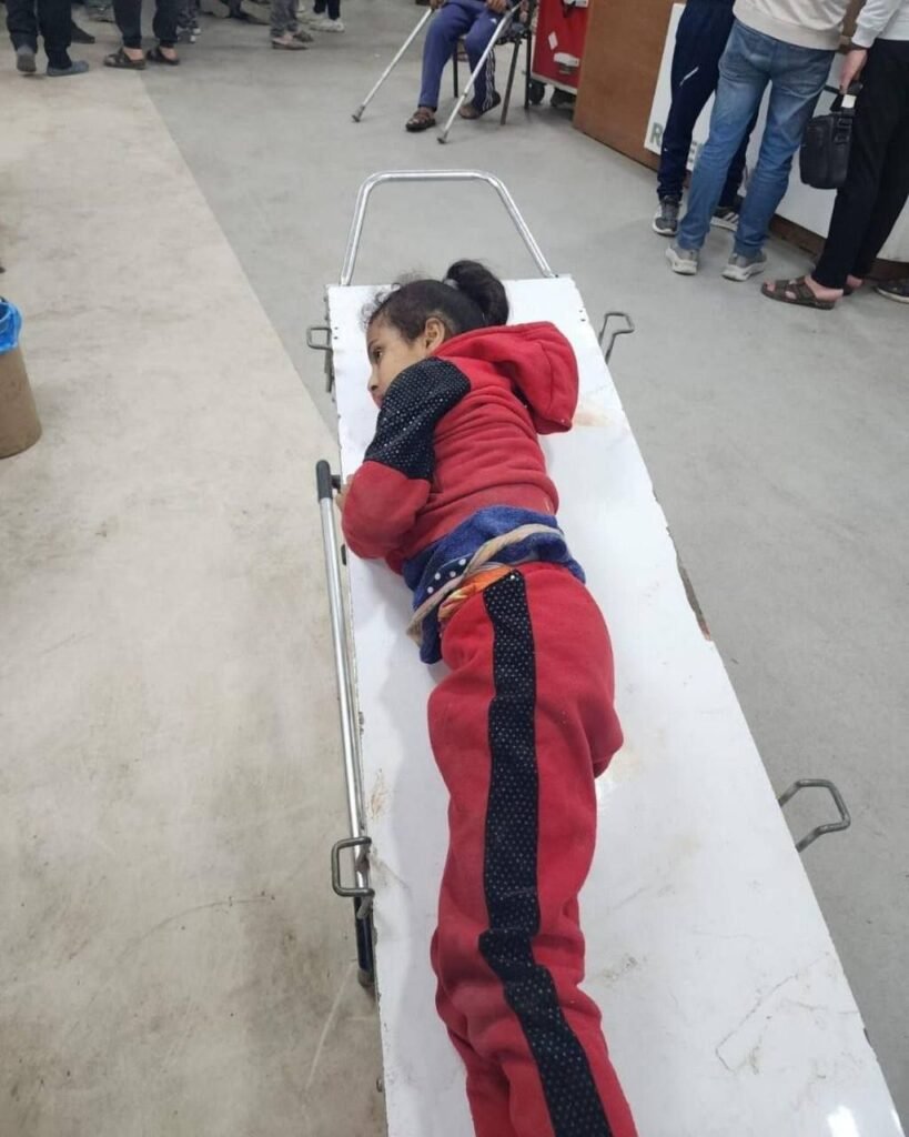img_20240319_165052_6235042799110253537445-819x1024 Injuries and the bodies of martyrs are still arriving to the Shefa hospital following the attack by the occupation forces on Palestinians who were waiting for the humanitarian aids in the northern part of Gaza last night.
