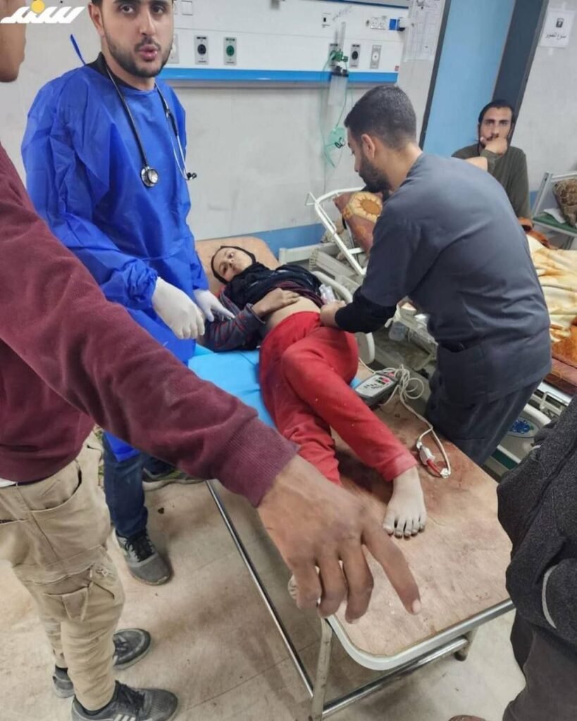 img_20240319_165052_9864373233267852444621-819x1024 Injuries and the bodies of martyrs are still arriving to the Shefa hospital following the attack by the occupation forces on Palestinians who were waiting for the humanitarian aids in the northern part of Gaza last night.